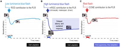 Chromatic pupillometry for evaluating melanopsin retinal ganglion cell function in Alzheimer’s disease and other neurodegenerative disorders: a review